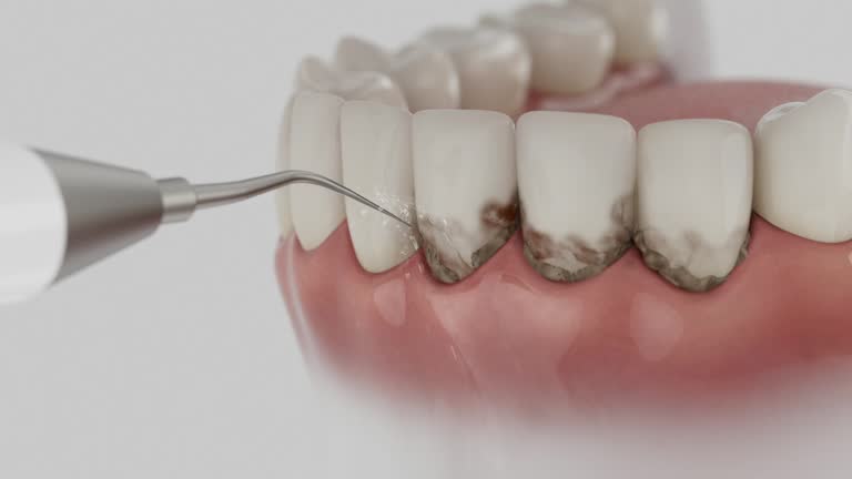 Reliable Emergency Dentist contractor in Morrow, OH by Smile Center Dentistry